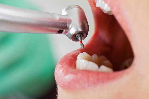 Best Knocked-Out Tooth Emergency  in Mapleton, IA